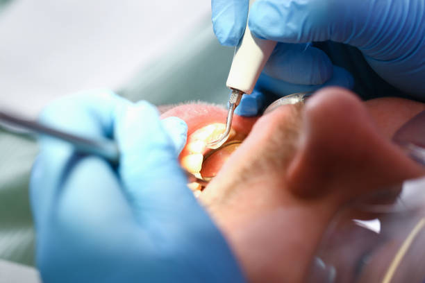Best Pediatric Emergency Dentist in Moodus, CT