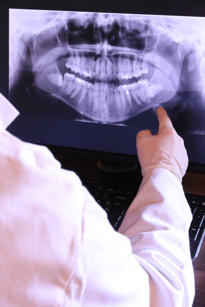 Best Emergency Dentist for Lost Fillings or Crowns in Moodus, CT
